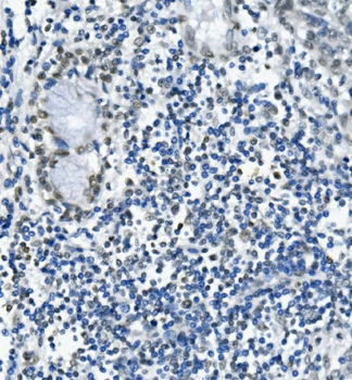 RNA Helicase A/DHX9 Rabbit Polyclonal Antibody