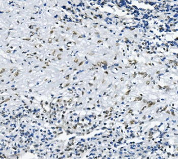 RNA Helicase A/DHX9 Rabbit Polyclonal Antibody