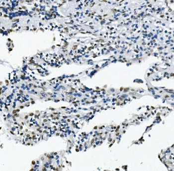 RNA Helicase A/DHX9 Rabbit Polyclonal Antibody