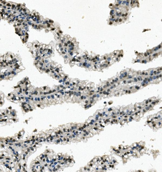 RNA Helicase A/DHX9 Rabbit Polyclonal Antibody