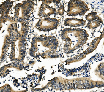DNAJA2 Rabbit Polyclonal Antibody