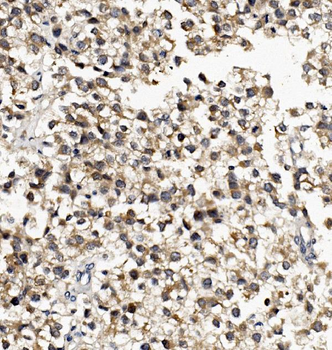 DNAJA2 Rabbit Polyclonal Antibody
