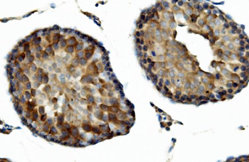 DNAJA2 Rabbit Polyclonal Antibody
