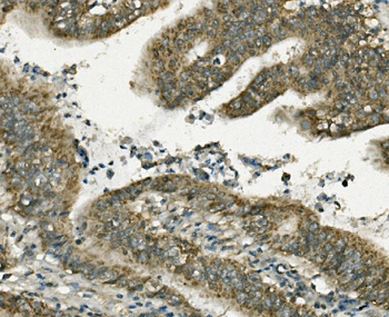 FABP6 Rabbit Polyclonal Antibody