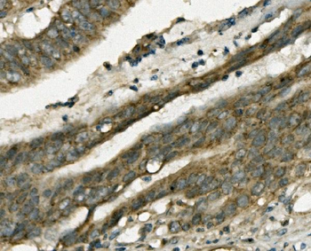 FABP6 Rabbit Polyclonal Antibody