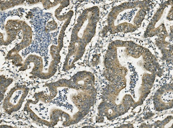 FABP6 Rabbit Polyclonal Antibody
