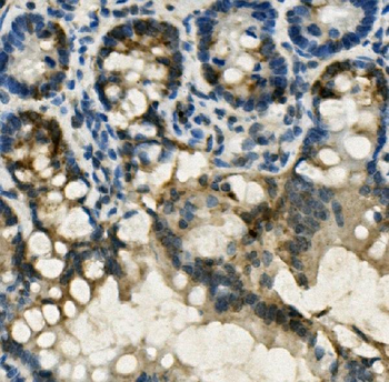 FABP6 Rabbit Polyclonal Antibody