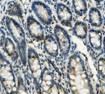 FABP6 Rabbit Polyclonal Antibody