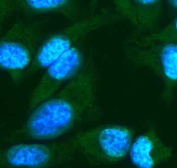 FGF10 Rabbit Polyclonal Antibody