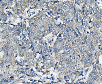 TTC11/FIS1 Rabbit Polyclonal Antibody