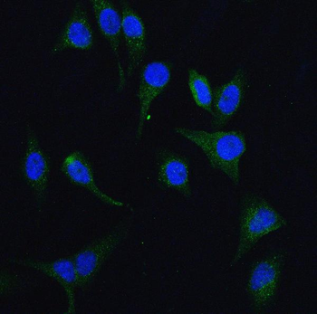 HGS Rabbit Polyclonal Antibody