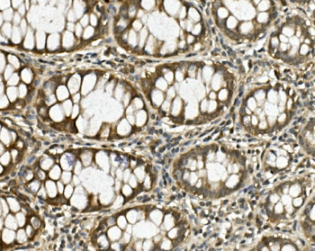 HGS Rabbit Polyclonal Antibody
