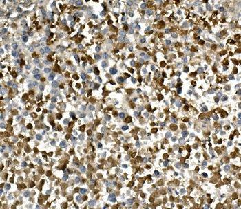 HGS Rabbit Polyclonal Antibody