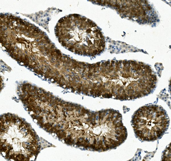 IFT88 Rabbit Polyclonal Antibody