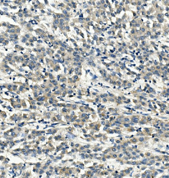 LDL Receptor/LDLR Rabbit Polyclonal Antibody