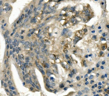 LDL Receptor/LDLR Rabbit Polyclonal Antibody