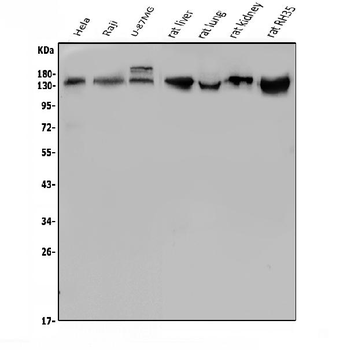 LDL Receptor/LDLR Rabbit Polyclonal Antibody