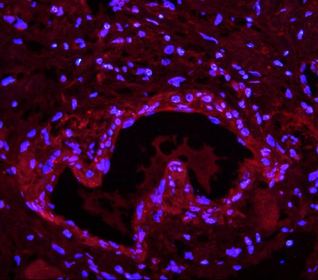 Lin28/LIN28A Rabbit Polyclonal Antibody