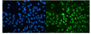 MBD4/MED1 Rabbit Polyclonal Antibody