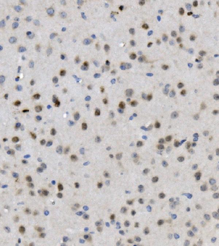 MBD4/MED1 Rabbit Polyclonal Antibody