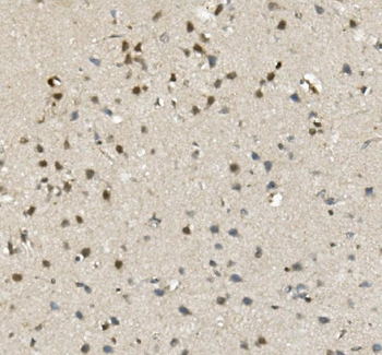 MBD4/MED1 Rabbit Polyclonal Antibody