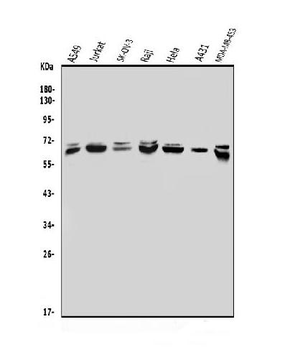 MBD4/MED1 Rabbit Polyclonal Antibody