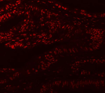 MBNL1 Rabbit Polyclonal Antibody