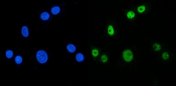 MBNL1 Rabbit Polyclonal Antibody