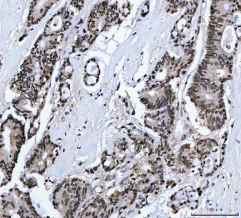 MBNL1 Rabbit Polyclonal Antibody