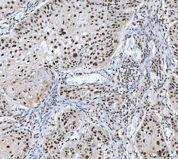 MBNL1 Rabbit Polyclonal Antibody