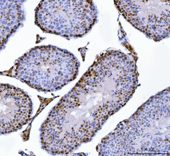 MBNL1 Rabbit Polyclonal Antibody