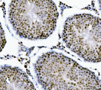 MBNL1 Rabbit Polyclonal Antibody