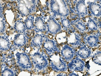 CD146/Mcam Rabbit Polyclonal Antibody
