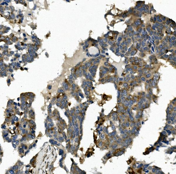 ME2 Rabbit Polyclonal Antibody
