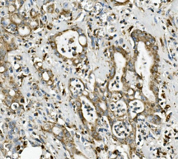 ME2 Rabbit Polyclonal Antibody