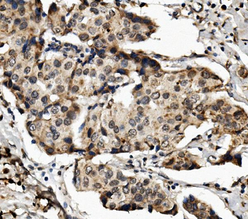 MED4 Rabbit Polyclonal Antibody
