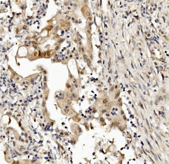 MED4 Rabbit Polyclonal Antibody