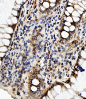 MED4 Rabbit Polyclonal Antibody