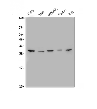 MESP1 Rabbit Polyclonal Antibody