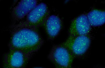 Nectin 2/NECTIN2 Rabbit Polyclonal Antibody