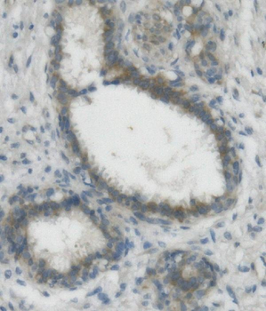 Nectin 2/NECTIN2 Rabbit Polyclonal Antibody
