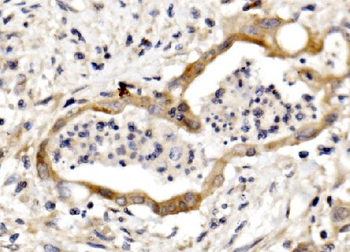 Nectin 3/NECTIN3 Rabbit Polyclonal Antibody