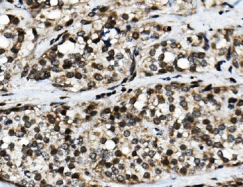 NFIC/CTF Rabbit Polyclonal Antibody
