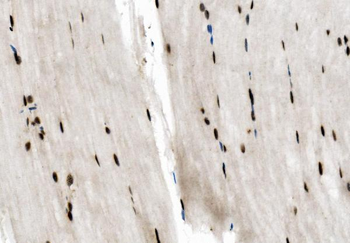 NFIC/CTF Rabbit Polyclonal Antibody