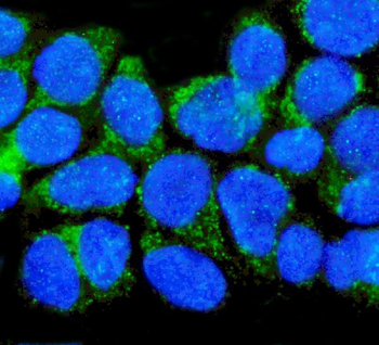 p75 NGF Receptor/NGFR Rabbit Polyclonal Antibody