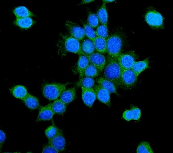 PCK2 Rabbit Polyclonal Antibody
