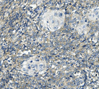 PHEX Rabbit Polyclonal Antibody
