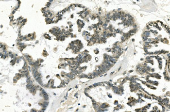 PHEX Rabbit Polyclonal Antibody