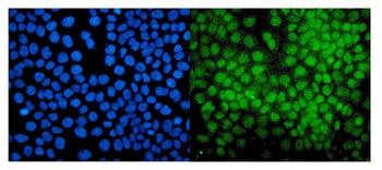 E3 SUMO-protein ligase PIAS1 PIAS1/SUMO Rabbit Polyclonal Antibody