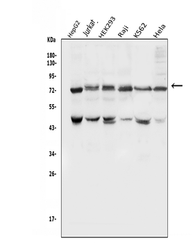 E3 SUMO-protein ligase PIAS1 PIAS1/SUMO Rabbit Polyclonal Antibody